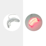 Dental Red Light Therapy Instrument Teeth Pain Cold Sore Canker Treatment Infrared Light for Mouth Oral Physiotherapy Tool