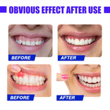 Dental Red Light Therapy Instrument Teeth Pain Cold Sore Canker Treatment Infrared Light for Mouth Oral Physiotherapy Tool