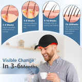 Hair Growth Cap Red Light Therapy Cap Device Anti Hair Loss Led Hair Growth Hat Near Infrared Relax Head Treatment 70x630nm